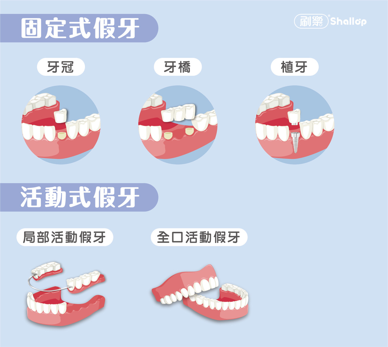 刷樂口腔保健室-拔牙一定要裝假牙嗎?