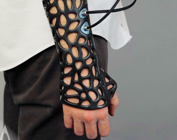 利用3D 生物打印機打印專屬於個人化的手臂固定器，取代傳統石膏。
