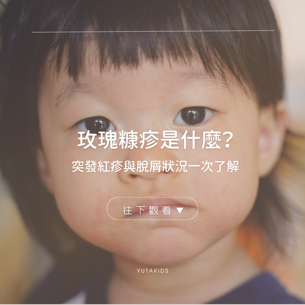 pityriasis-rosea-symptoms-care