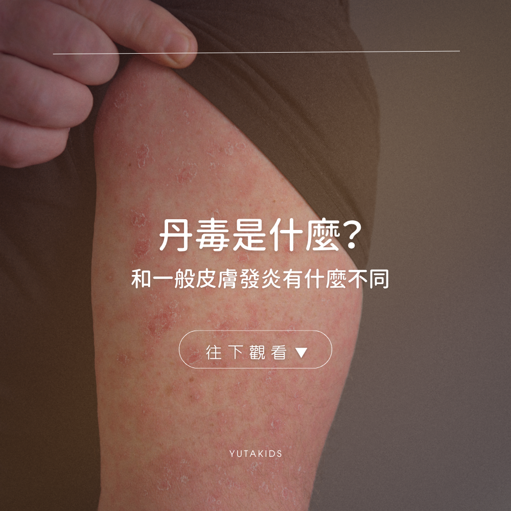 erysipelas-vs-skin-inflammation-guide