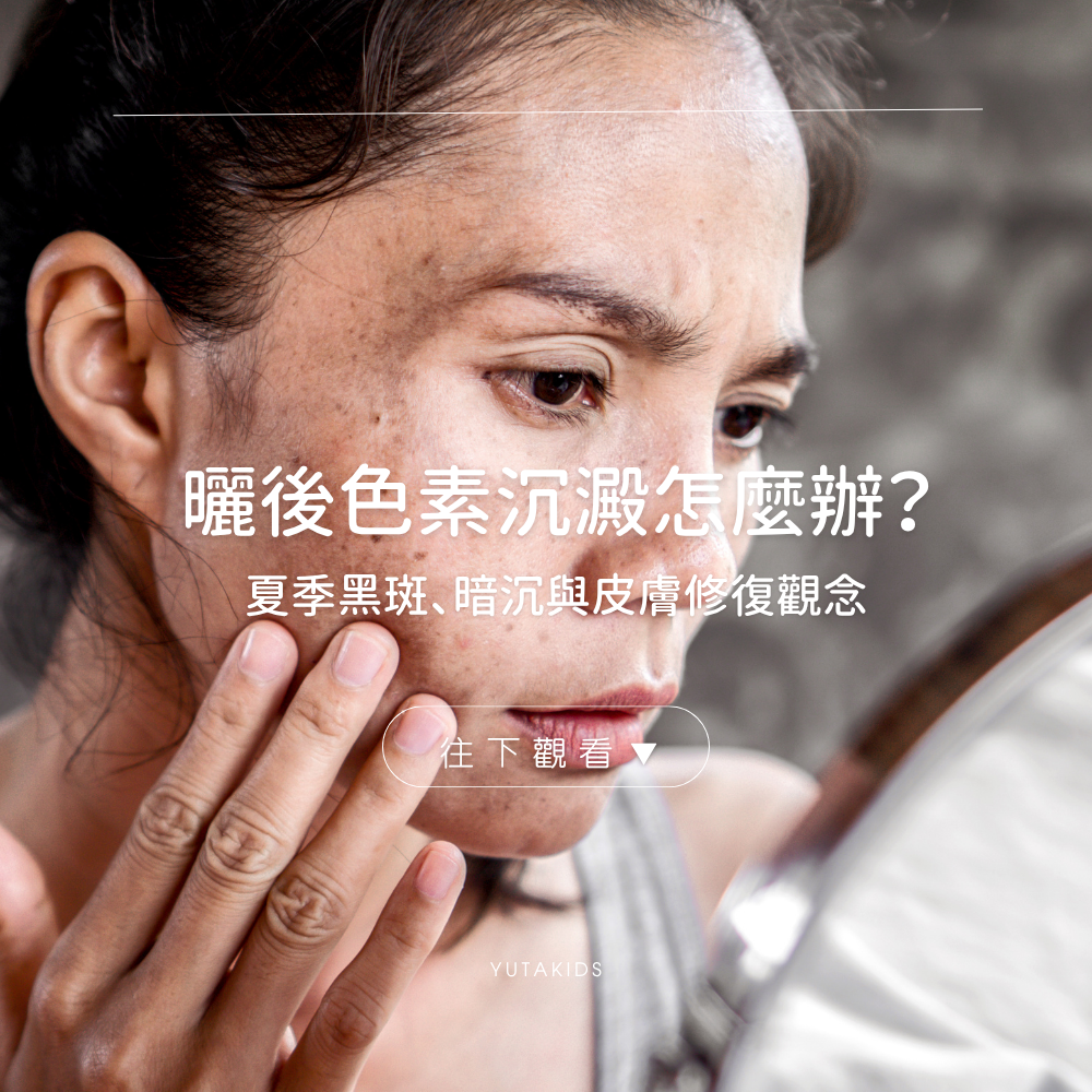 after-sun-pigmentation-care