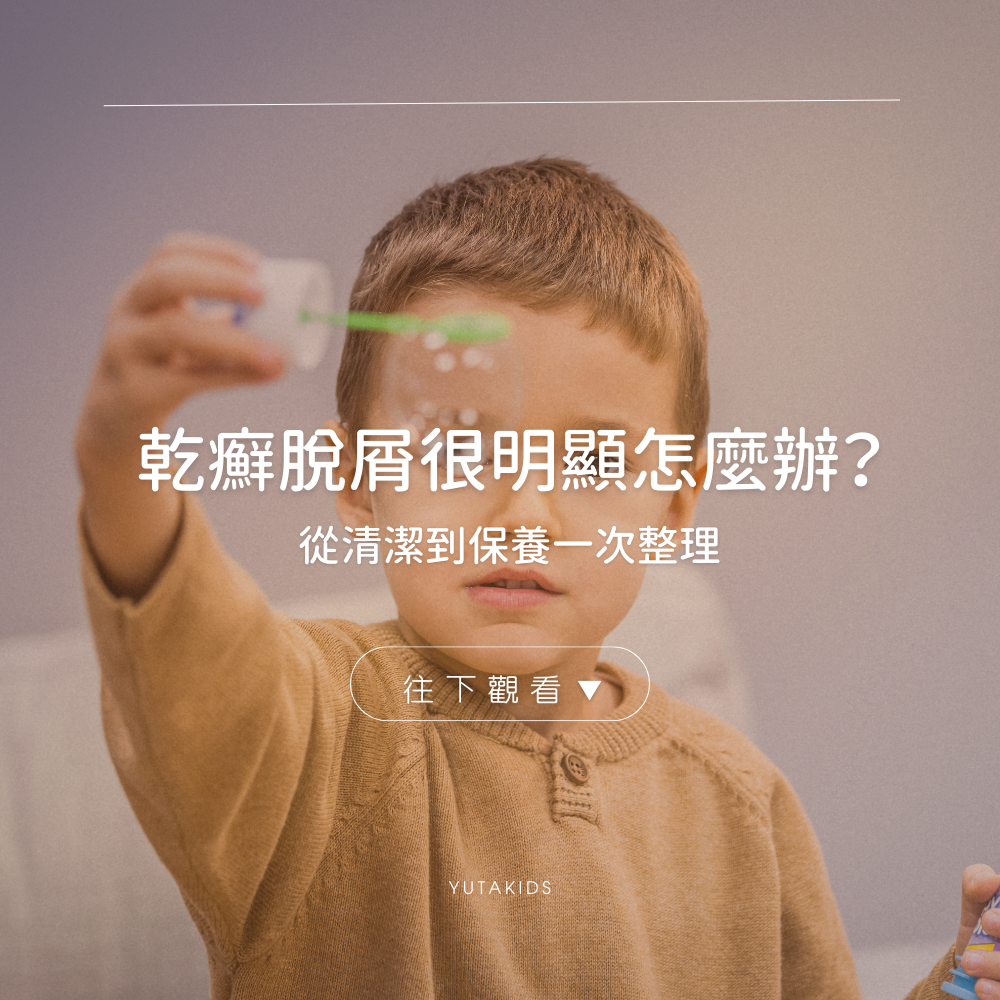 psoriasis-flaking-care-guide