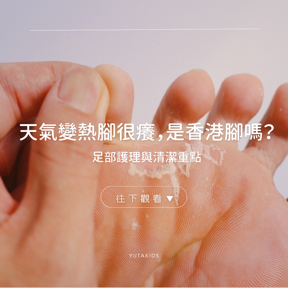 hot-weather-itchy-feet-care-guide