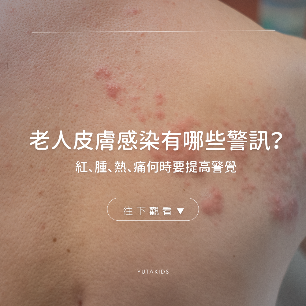 elderly-skin-infection-warning-signs