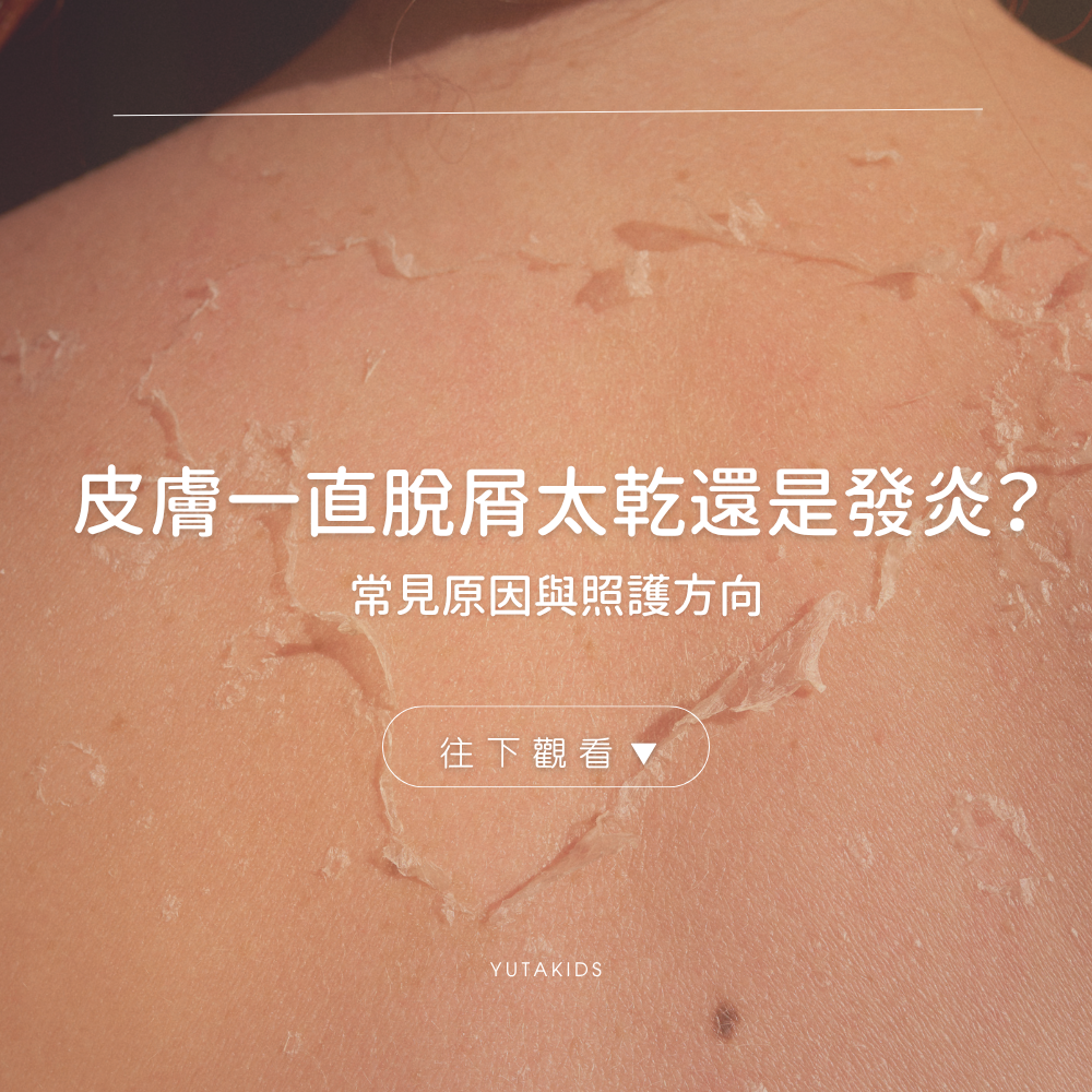 flaky-skin-dryness-or-inflammation-yutakids