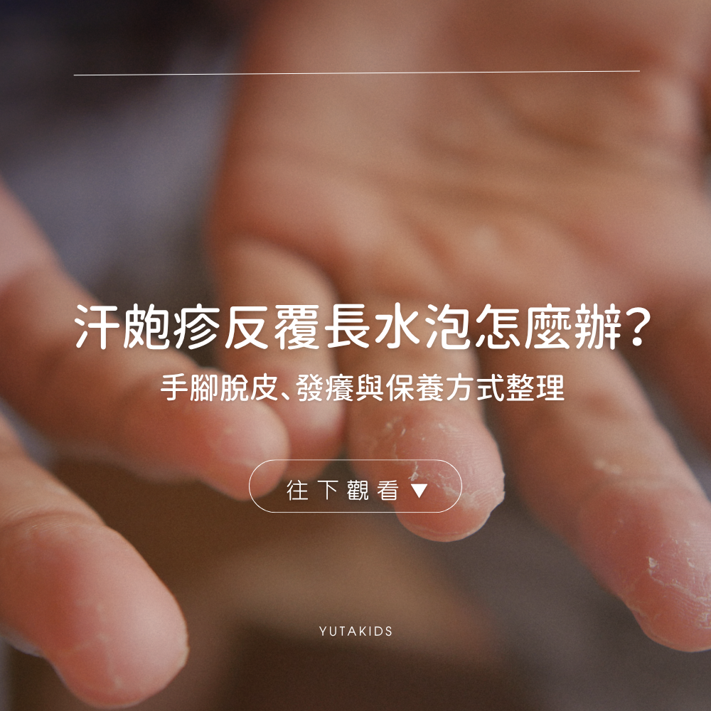 dyshidrotic-eczema-blisters-peeling-care