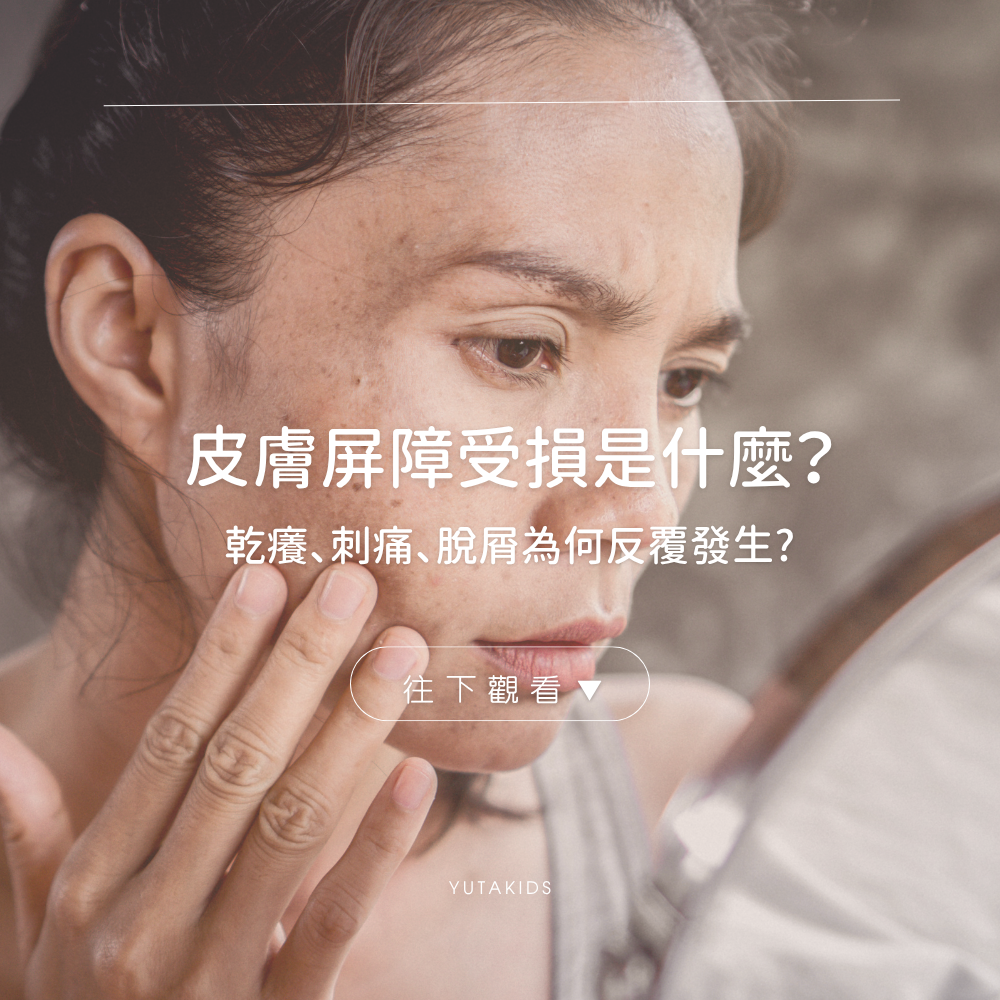 skin-barrier-damage-dry-itchy-flaky-guide