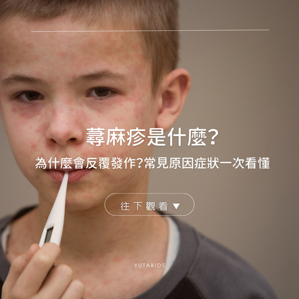 urticaria-causes-symptoms-guide