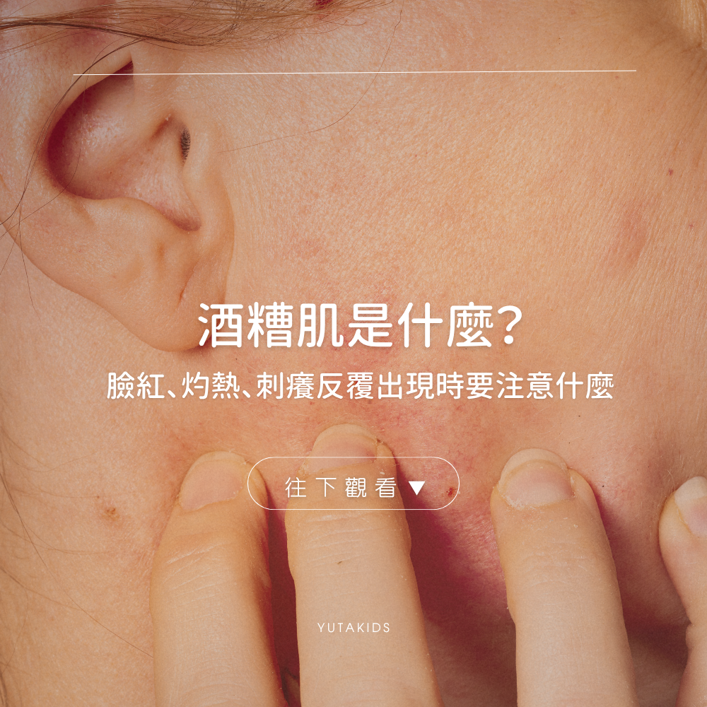 rosacea-redness-burning-itch-care