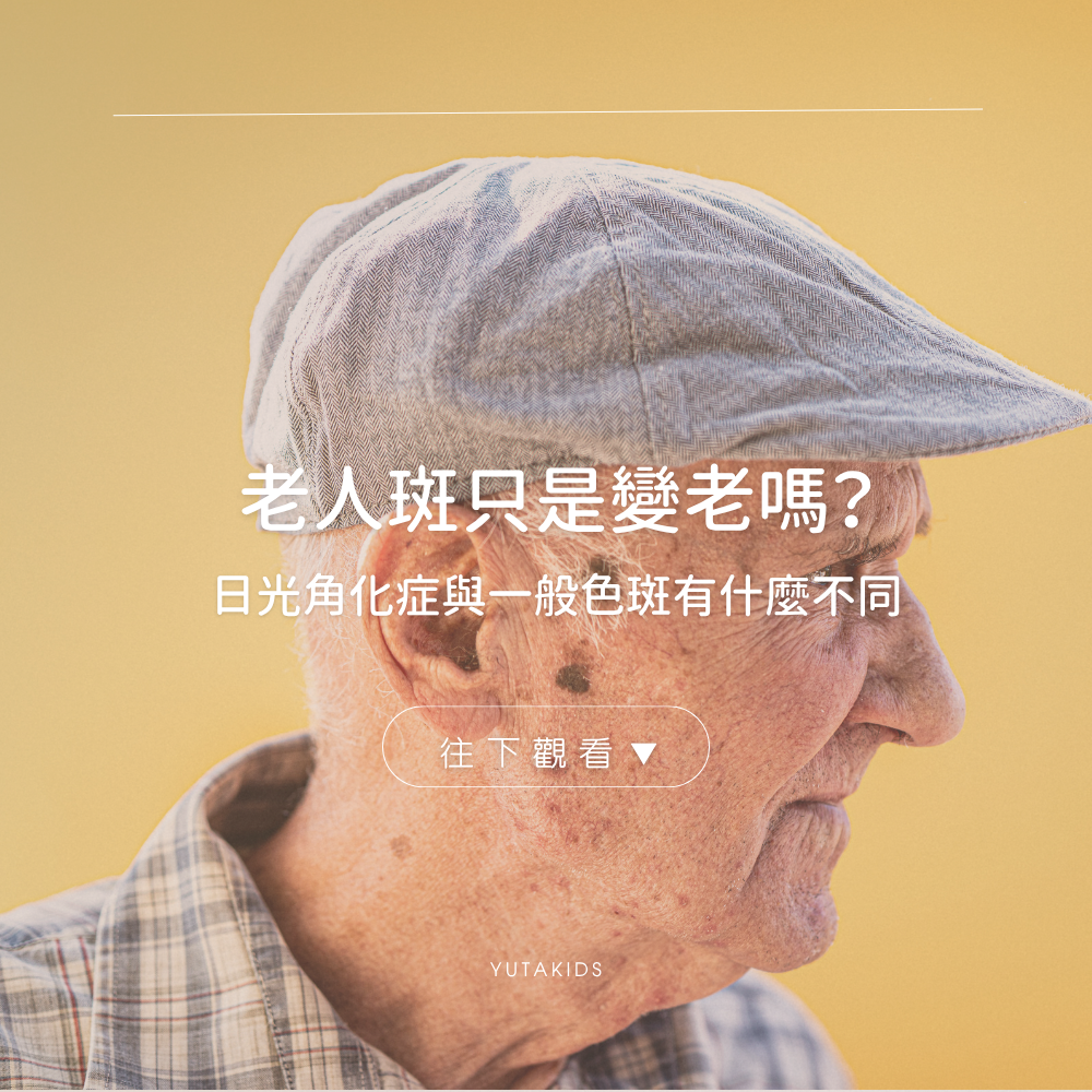 age-spots-vs-actinic-keratosis