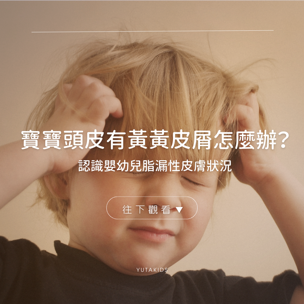 baby-scalp-yellow-flakes-seborrheic-care