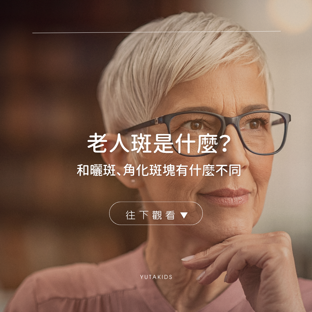 age-spots-sun-spots-keratotic-plaques-difference