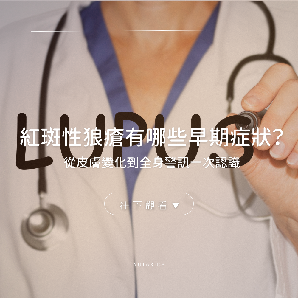 lupus-early-symptoms-guide