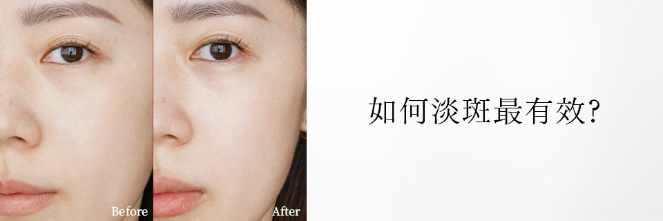 淡斑之前推薦先懂斑！從4大斑點成因開始了解如何淡斑