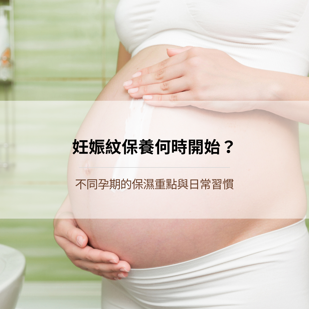 when-to-start-stretch-mark-care-pregnancy