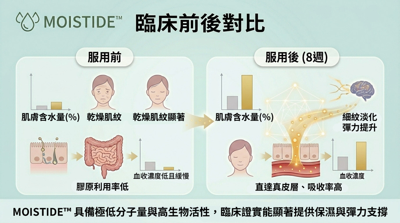 MOISTIDE 臨床前後對比