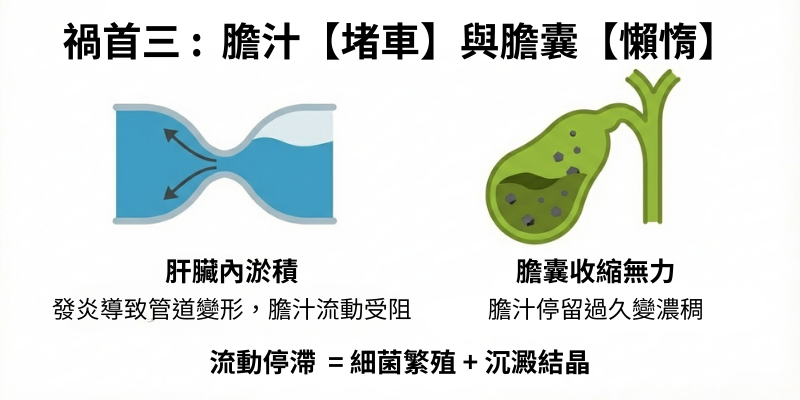 膽汁堵車與膽囊懶惰
