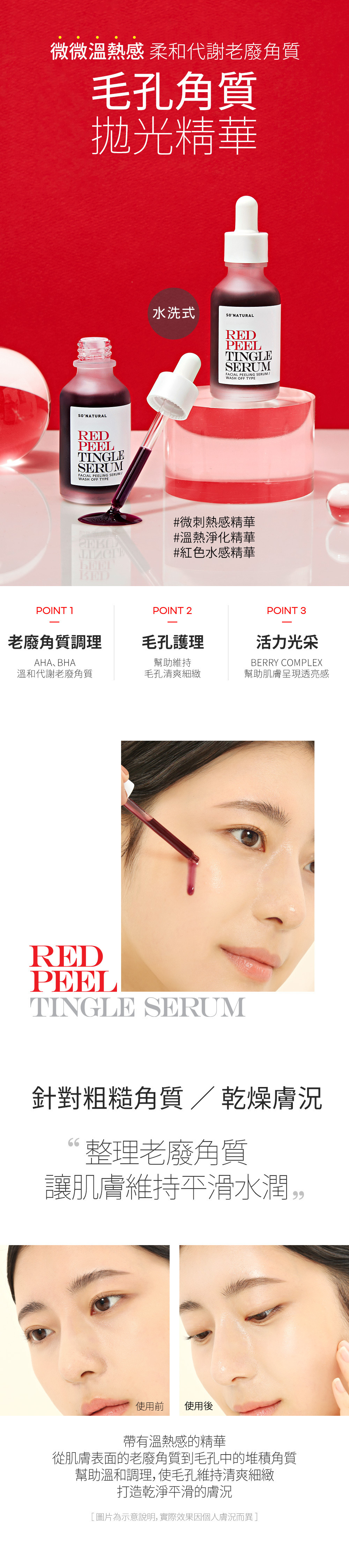 SO NATURAL 紅色微刺拋光精華35ml