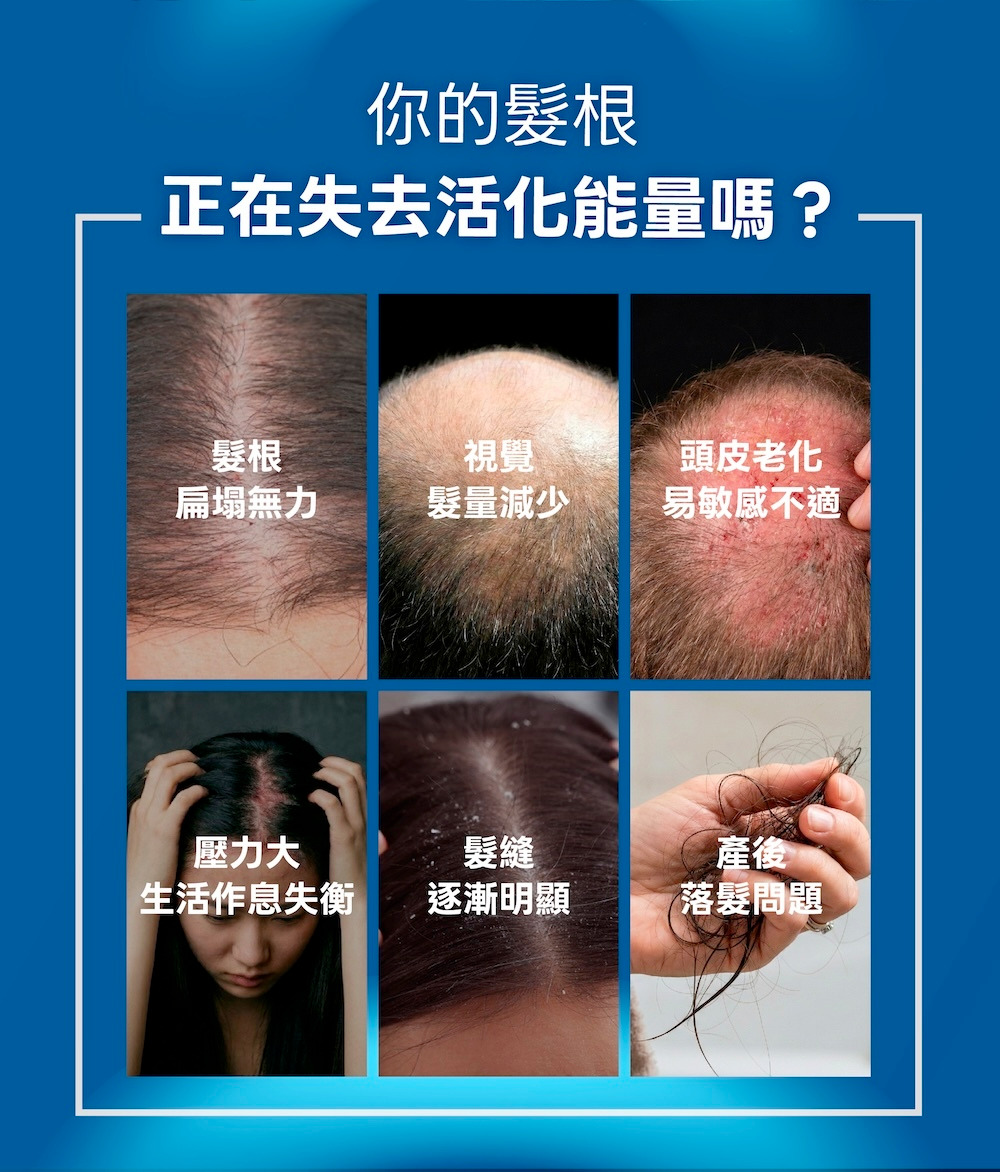 LA EXO 萊泌兒 999 外泌體養髮液